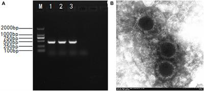 Isolation and Phylogenetic Analysis of Reemerging Pseudorabies Virus Within Pig Populations in Central China During 2012 to 2019